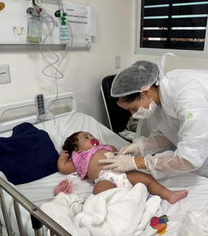 Enfermeiras alertam sobre o que fazer em caso de queimaduras nas festas juninas