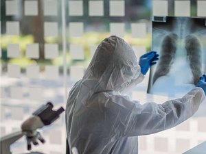 Agência de saúde dos EUA lista seis novos sintomas da covid-19