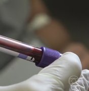 Licitação de laboratório envolvido em infecção por HIV será investigada