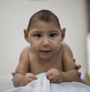 Microcefalia ganha semana nacional com fim à conscientização