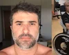 Ex-comandante aéreo de AL morre mais de um ano após ser baleado em operação no Rio