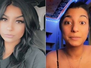 Americana tem parte do crânio retirado por causa de grave quadro de sinusite