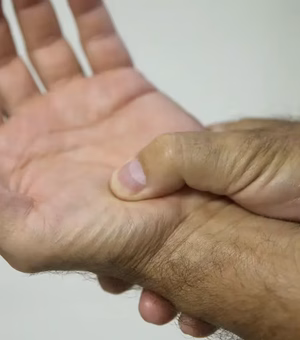 Fibromialgia passa a ser reconhecida por lei como deficiência: veja os direitos garantidos