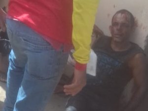 Homem é atingido por disparo de arma de fogo numa tentativa de homicídio em Arapiraca