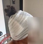 Mulher ataca companheiro com facão por não deixá-la entrar em casa na zona rural de Feira Grande