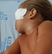 Bebê perde olho após cair na cozinha de casa, em Arapiraca