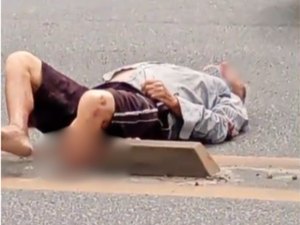 Homem é atropelado por moto e sofre fratura exposta na Av. Menino Marcelo