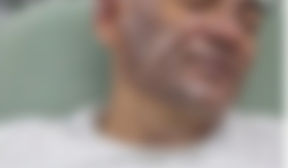 Sargento sofre queimadura ao ser atingido por óleo quente durante ocorrência com paciente psiquiátrico