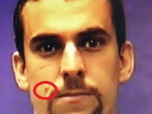 Preso no Paraguai, traficante Marcelo Piloto retirou sinal do rosto