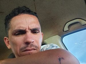 Pedreiro sofre acidente em SC ao fugir de confusão e precisa de doações para voltar para AL