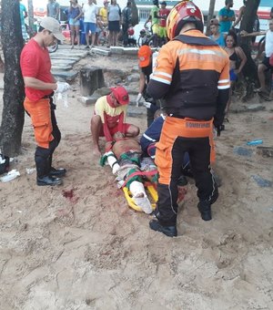 Homem atacado por tubarão no Recife corre risco de morrer, afirma médico