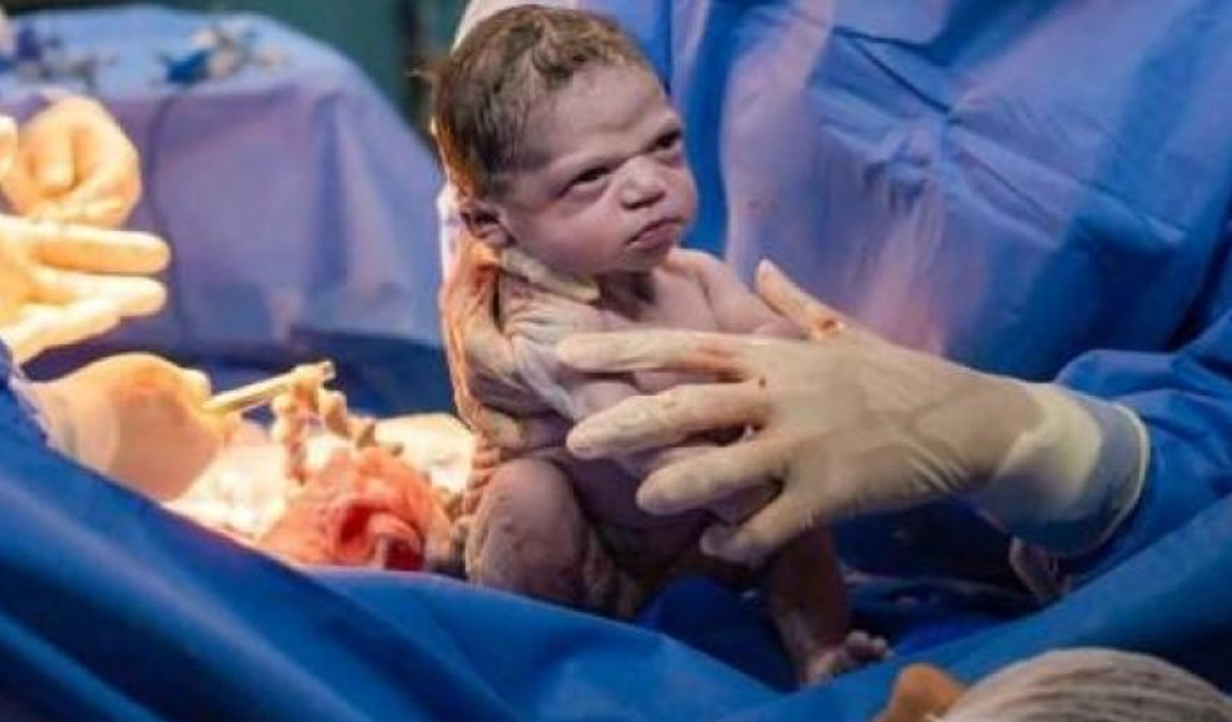 Família sabia que 'bebê brava' viraria meme, segundo fotógrafo do parto