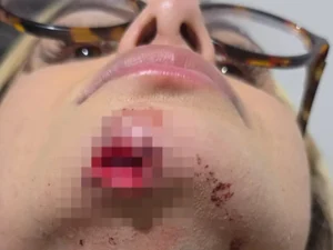 Influenciadora relata agressão de ex e diz ter sido arrastada no asfalto por mais de 100 metros