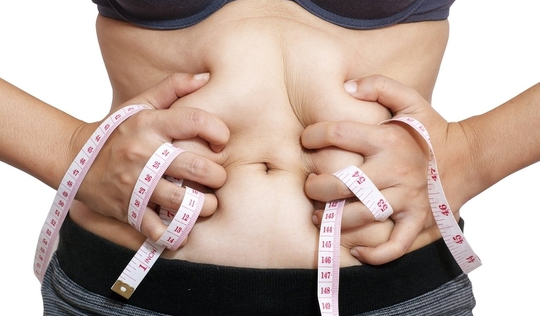 Pacientes sem obesidade mórbida podem realizar cirurgia bariátrica; entenda!
