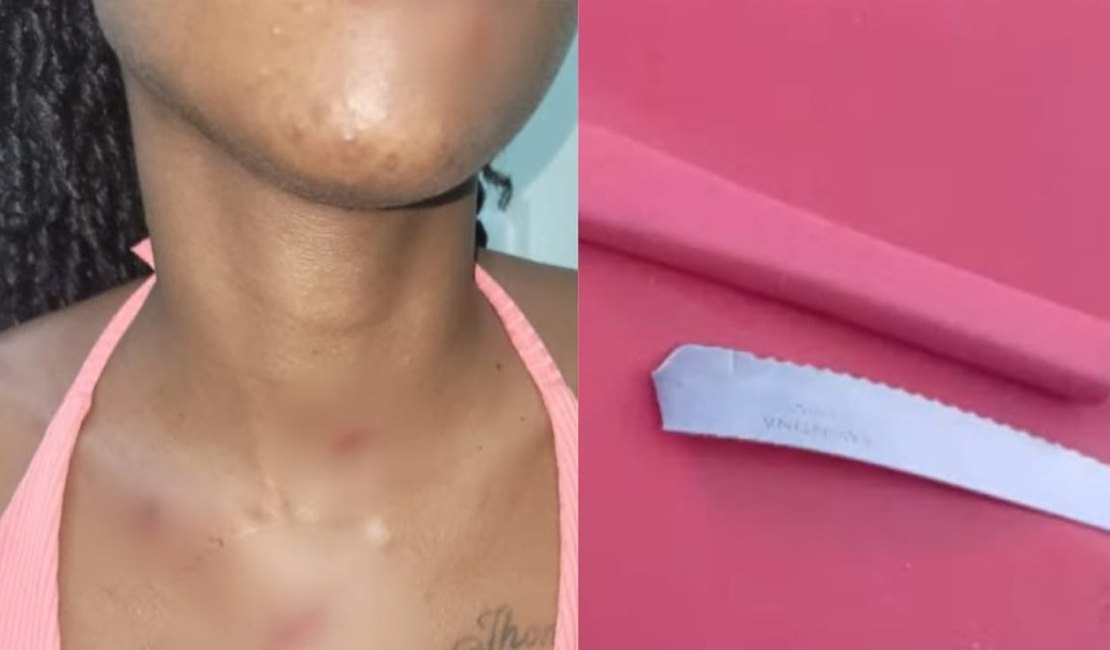 Mulher escapa de ser morta a facadas em Maceió após faca quebrar; ex foi preso