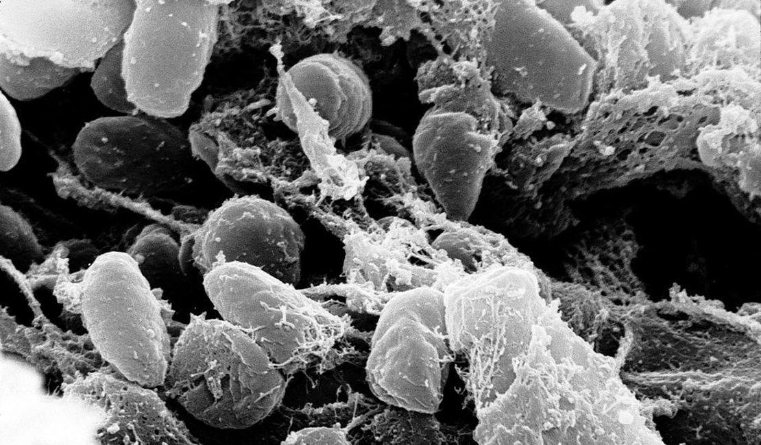 Paciente nos EUA morre depois de contrair bactéria que causou Grande Peste da Idade Média