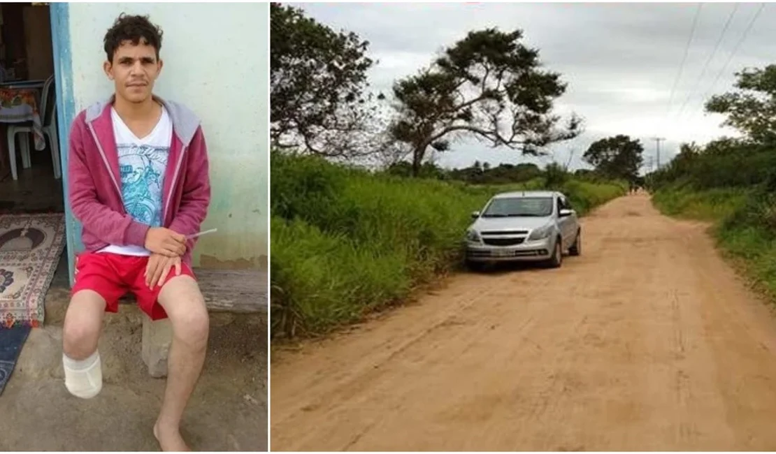 Servidor que amputou o próprio pé alegou que perdeu membro em sequestro