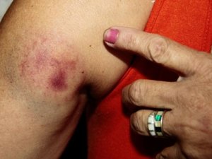 Filho agride mãe e desacata polícia, em Arapiraca