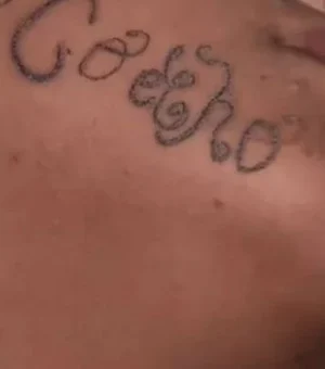 Mãe vai à polícia após encontrar filha com nome do ex tatuado no rosto