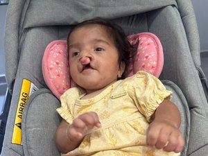 Família faz rifa para custear cirurgias de bebê nascida com malformações