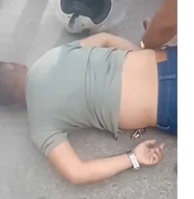 Queda de moto deixa homem ferido no Trevo da Perucaba, em Arapiraca