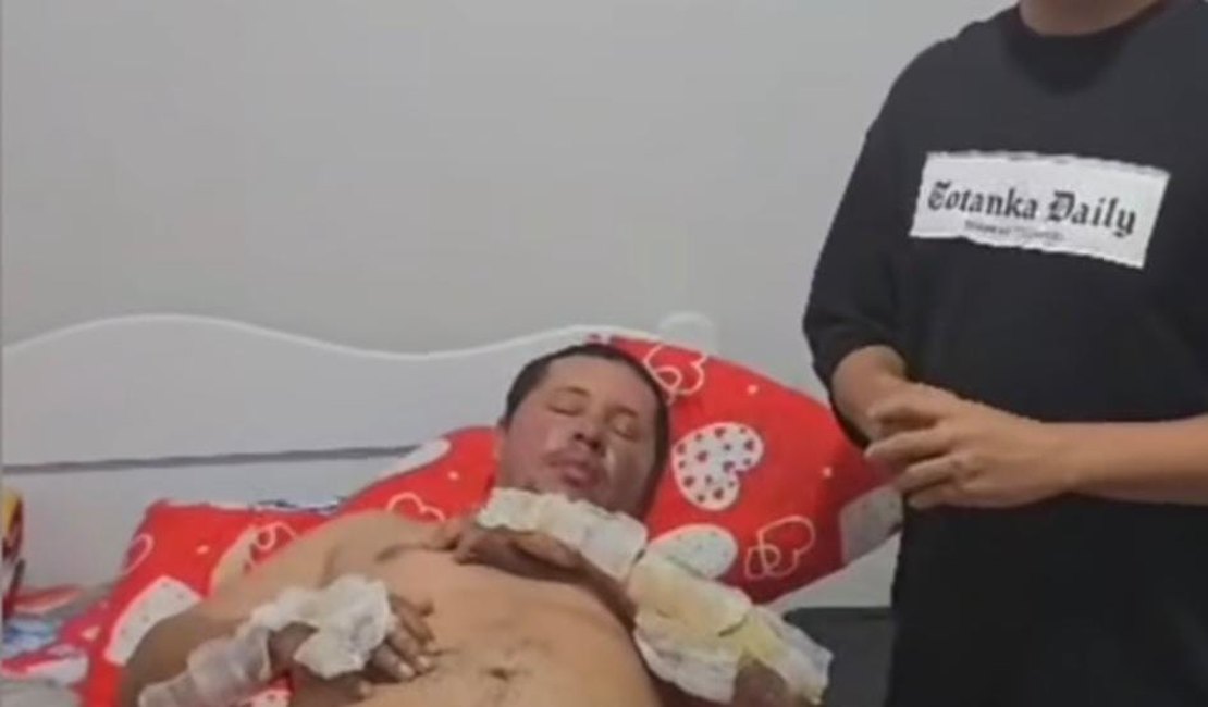 Motorista de app que teve corpo incendiado pede ajuda para tratamento