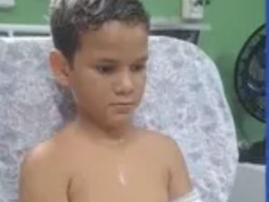 Menino de 10 anos tem parte do braço amputada após acidente na BR-316, em Maribondo