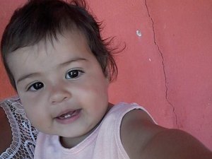 Criança de 2 anos precisa de cirurgia de catarata