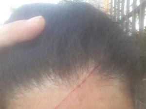 Gavião ataca e atormenta vida de moradora em SP: 'estamos priosioneiros'