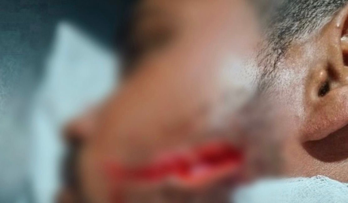 Jovem é atingido por facada no rosto durante vaquejada em Delmiro Gouveia
