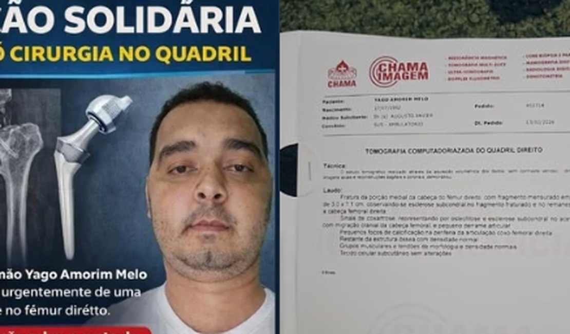 Marceneiro de Arapiraca faz vaquinha para custear cirurgia de R$ 40 mil no quadril