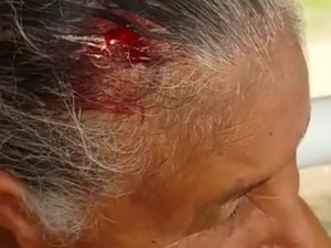 [Vídeo] Idosa sofre corte na cabeça em estrutura de terminal em Arapiraca