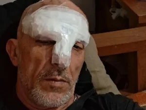 Cristian Cravinhos teme voltar para a prisão após acidente; entenda