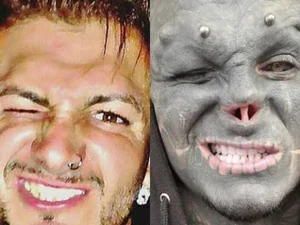 Homem quer amputar uma das pernas para se parecer com alienígena