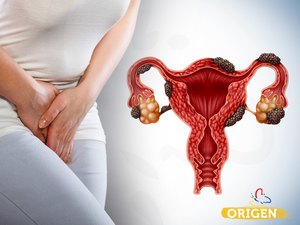 Endometriose: um alerta para o coração da mulher