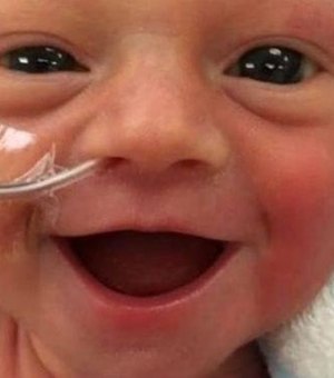 Internautas se encantam com sorriso de bebê prematuro