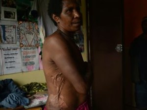 Caça às bruxas faz o terror imperar em Papua-Nova Guiné