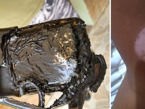 Celular que carregava ao lado da cama explode e queima estudante
