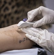 Em dois meses, Implanon é disponibilizado para mais de 600 mulheres