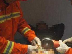 Bombeiros são acionados para retirar anéis presos em órgão genital masculino