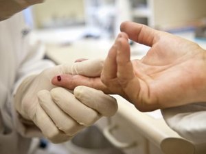 Remédio que previne contaminação pelo vírus HIV será oferecido pelo SUS este mês