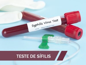 Tratamento brasileiro contra Aids se consolida como referência mundial