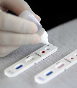Governo do Japão aprova novo teste de anticorpos para covid-19