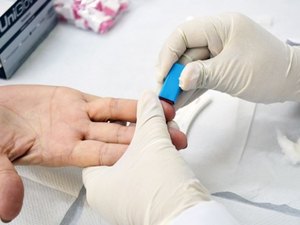 Helvio Auto fará testes para detectar hepatites B e C abertos à população
