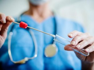 Estoque de testes de Covid-19 é crítico em Alagoas