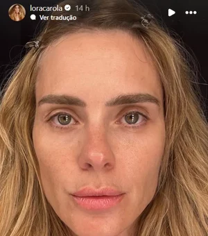 Carolina Dieckmann divulga foto sem filtro: 'Felizinha com minha pele'