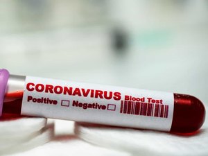 Covid-19: Sobe para 428 número de casos no Brasil
