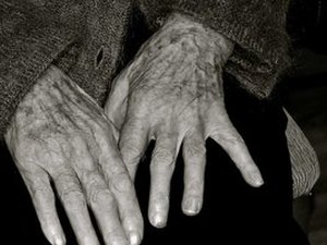 Idosa de 80 anos cai e sofre traumatismo craniano no Sertão 