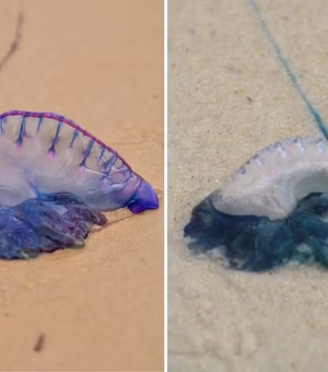 Jovem sofre queimaduras de caravelas no rosto, na Praia do Francês