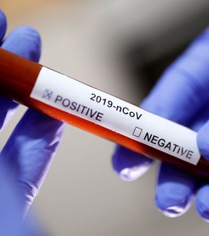 Catalunha: cientistas desenvolvem medicamento contra novo coronavírus